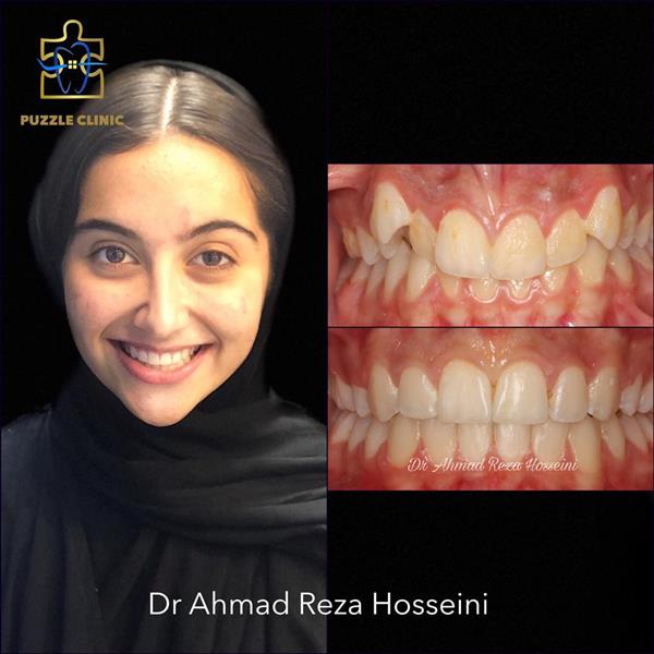 ارتودنسی و جراحی فک و صورت، درمان توسط دکتر احمدرضا حسینی