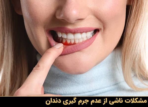 مشکلات ناشی از عدم جرم گیری دندان