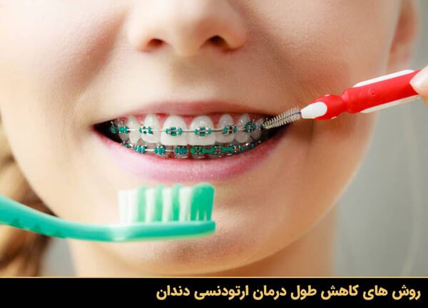 روش های کاهش طول درمان ارتودنسی دندان