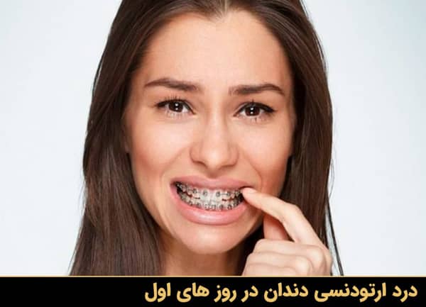 درد ارتودنسی دندان در روزهای اول