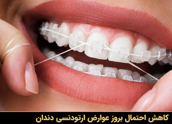 کاهش احتمال بروز عوارض ارتودنسی دندان