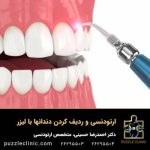 ارتودنسی و ردیف کردن دندانها با لیزر | هزینه ارتودنسی با لیزر
