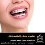مضرات و عوارض ارتودنسی دندان: آیا ارتودنسی ضرر دارد؟ + 8 عوارض