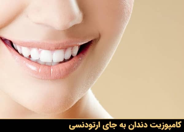 کامپوزیت دندان به جای ارتودنسی