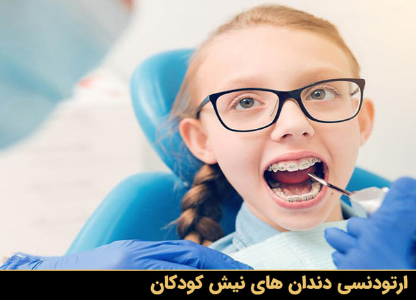 ارتودنسی دندان های نیش کودکان