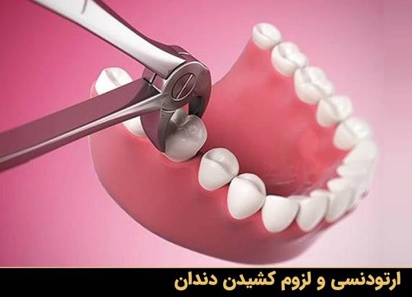 ارتودنسی و لزوم کشیدن دندان