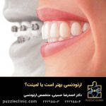 تفاوت ارتودنسی و لمینت دندان | ارتودنسی کنیم یا لمینت؟