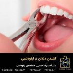کشیدن دندان در ارتودنسی | زمان مناسب + مزایا و معایب