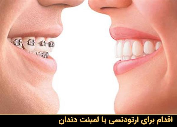 اقدام برای ارتودنسی یا لمینت دندان