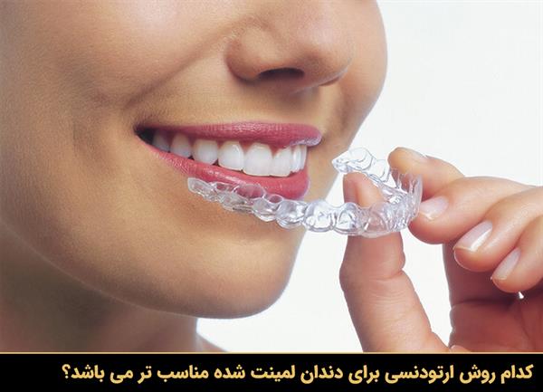 کدام روش ارتودنسی برای دندان لمینت شده مناسب تر می باشد؟