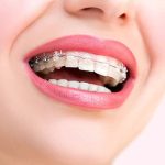 تاریخچه ارتودنسی دندان | ارتودنسی در گذشته چگونه بوده است؟