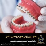 جدیدترین روشهای ارتودنسی دندان +مزایا و معایب 3 روش جدید ارتودنسی