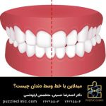 میدلاین یا خط وسط دندان چیست؟ | انواع انحراف میدلاین +روشهای اصلاح