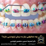چه دندانهایی نیاز به درمان ارتودنسی دارند؟