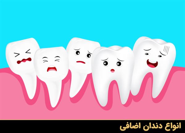 انواع دندان اضافی