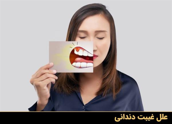 علل غیبت دندانی