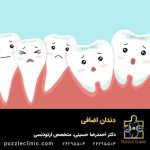 دندان اضافی چیست؟ | علت درآمدن دندان اضافه + درمان با ارتودنسی