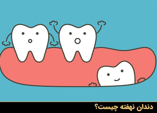 دندان نهفته چیست؟