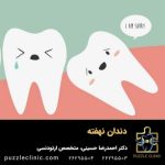 دندان نهفته چیست؟ | علائم و عوارض + ارتودنسی دندان نهفته