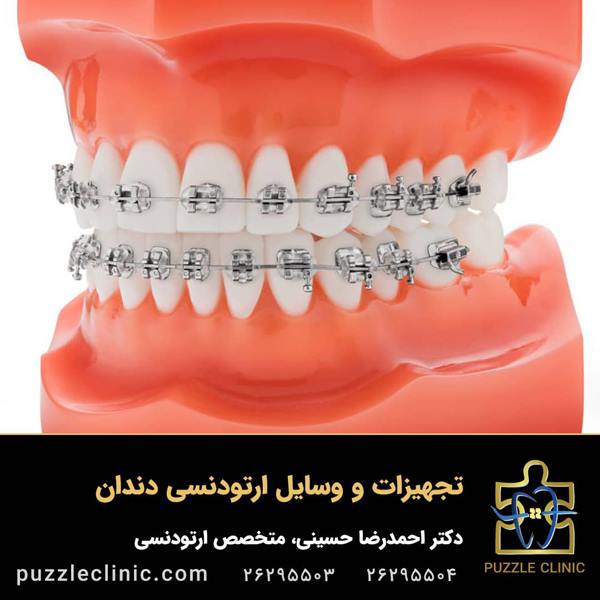 تجهیزات و وسایل ارتودنسی دندان