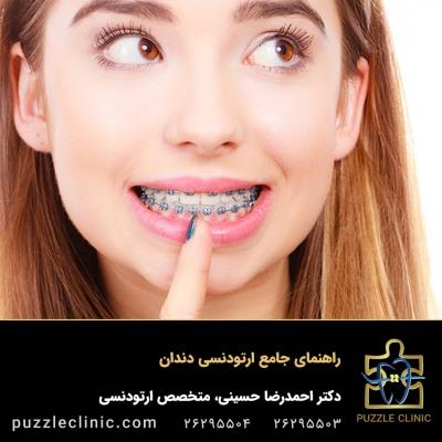 راهنمای جامع ارتودنسی دندان