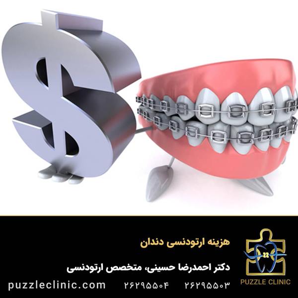 قیمت ارتودنسی دندان سال 1403